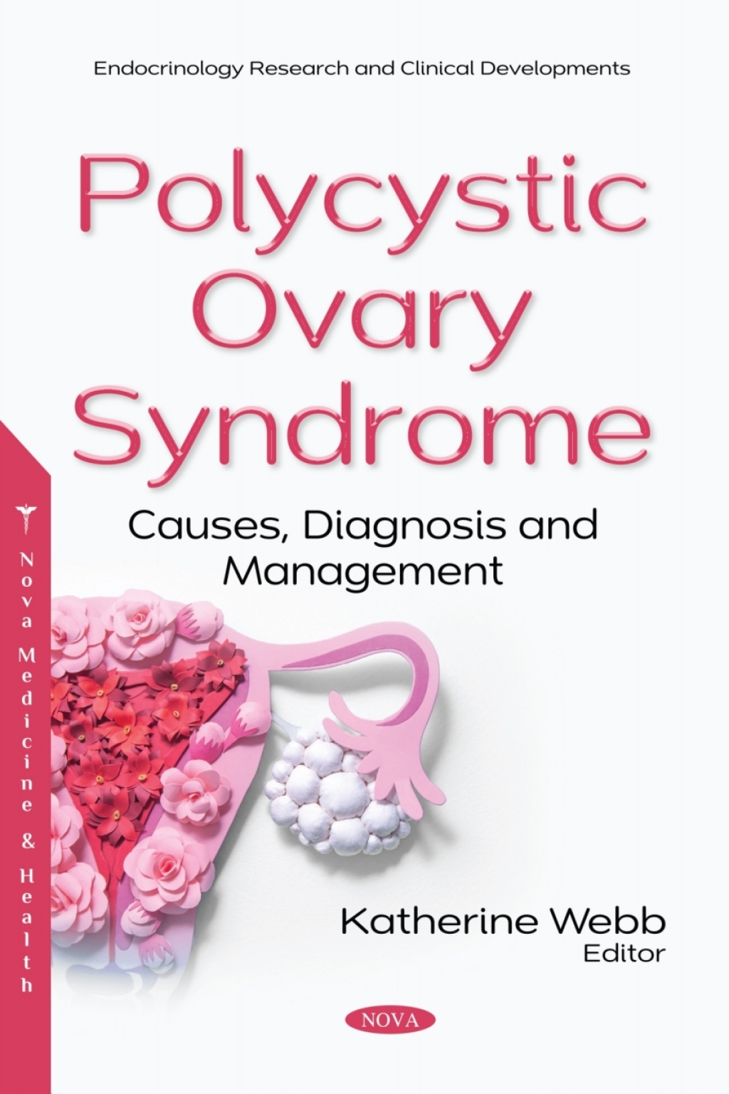 Polycystic Ovary Syndrome: Causes, Diagnosis and Management  â€“ PDF/EPUB Version Downloadable