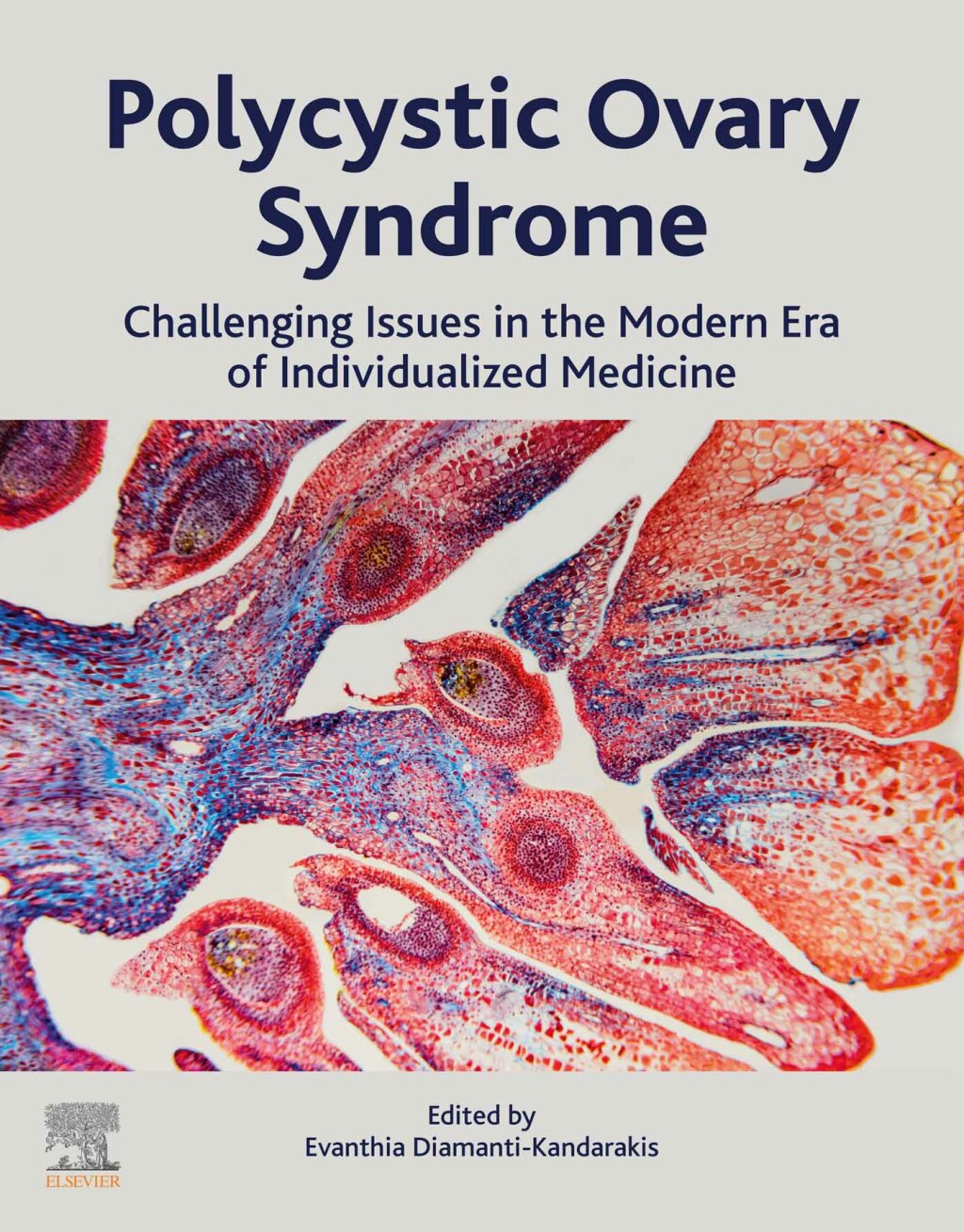 Polycystic Ovary Syndrome Challenging Issues in the Modern Era of Individualized Medicine  â€“ PDF/EPUB Version Downloadable