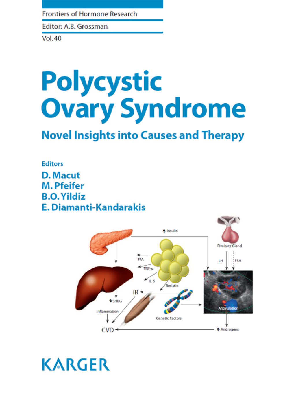 Polycystic Ovary Syndrome Novel Insights into Causes and Therapy 1st Edition â€“ PDF/EPUB Version Downloadable