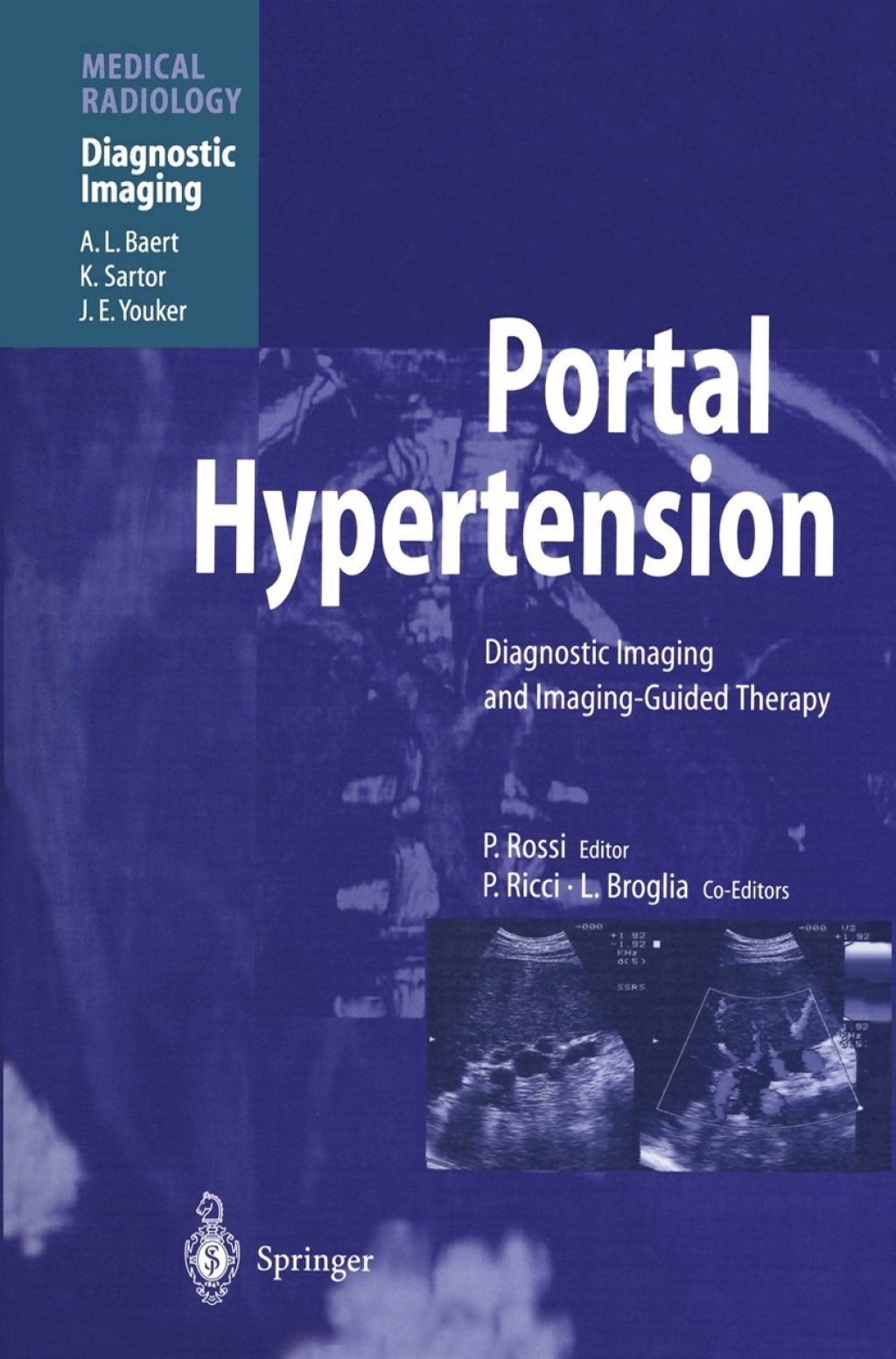 Portal Hypertension Diagnostic Imaging and Imaging-Guided Therapy 1st Edition â€“ PDF/EPUB Version Downloadable