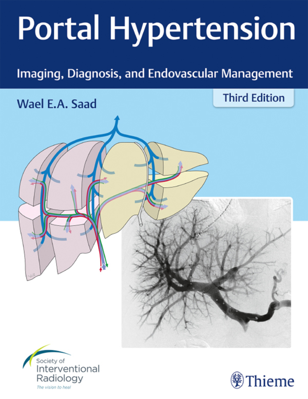 Portal Hypertension Imaging, Diagnosis, and Endovascular Management 3rd Edition â€“ PDF/EPUB Version Downloadable