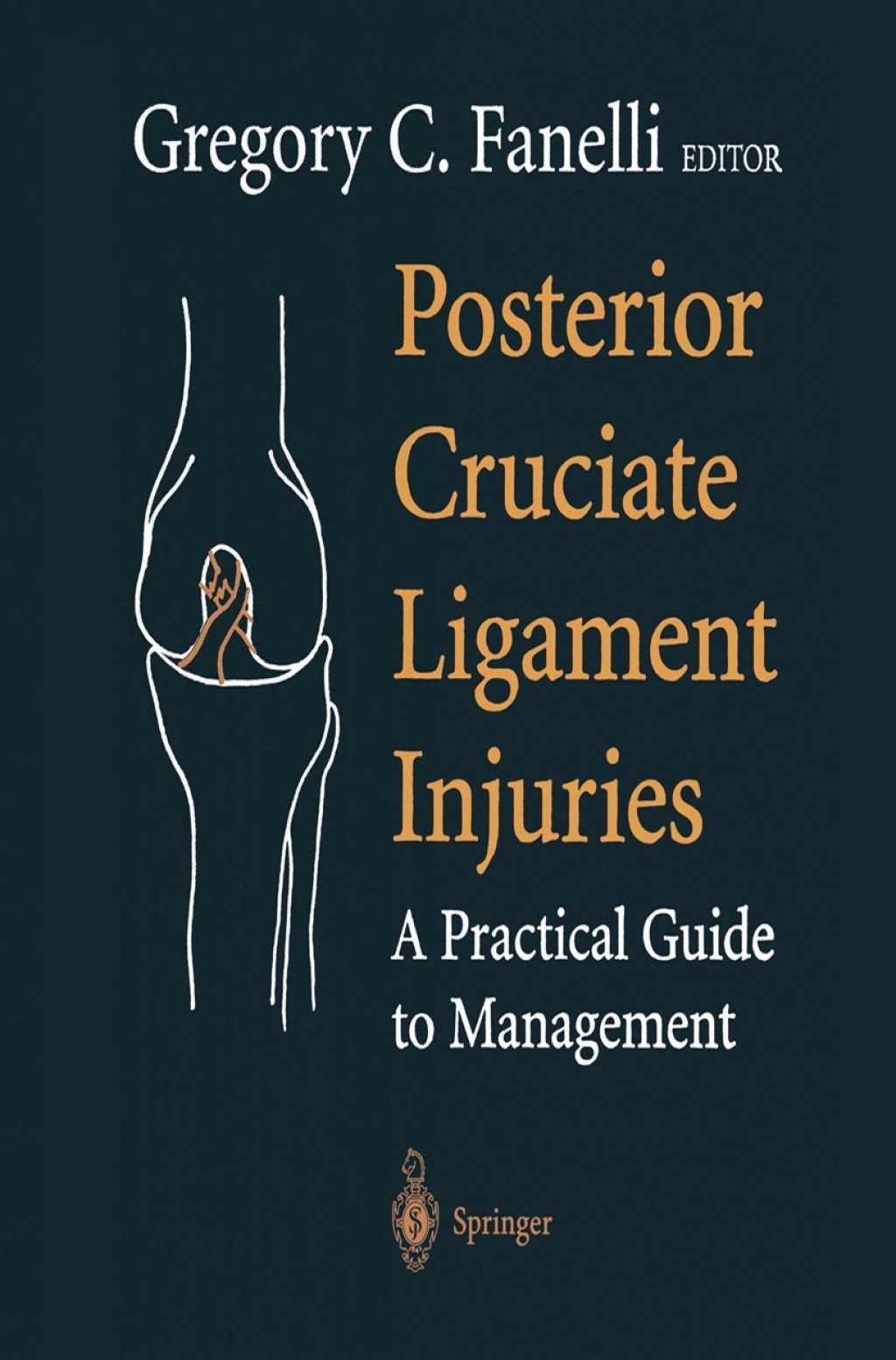 Posterior Cruciate Ligament Injuries A Practical Guide to Management 1st Edition â€“ PDF/EPUB Version Downloadable