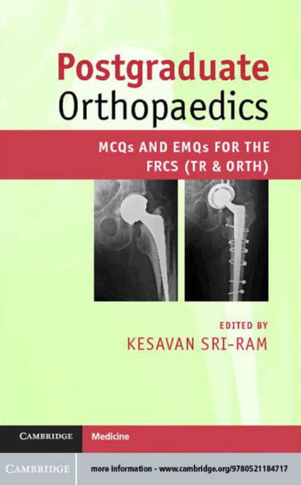 Postgraduate Orthopaedics MCQs and EMQs for the FRCS (Tr & Orth)  â€“ PDF/EPUB Version Downloadable