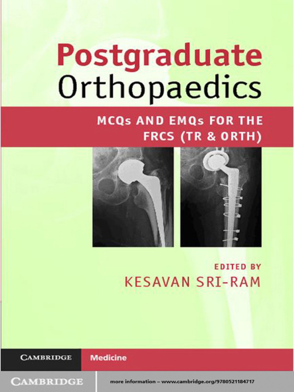 Postgraduate Orthopaedics MCQs and EMQs for the FRCS (Tr & Orth) 1st Edition â€“ PDF/EPUB Version Downloadable