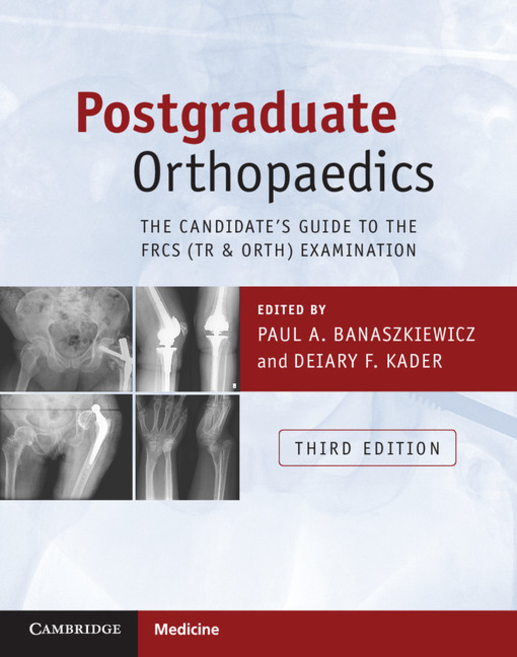 Postgraduate Orthopaedics The Candidate's Guide to the FRCS (Tr & Orth) Examination 3rd Edition â€“ PDF/EPUB Version Downloadable
