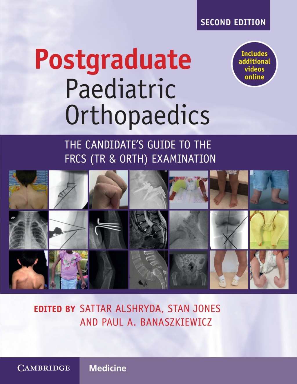 Postgraduate Paediatric Orthopaedics The Candidate's Guide to the FRCS(Tr&Orth) Examination 2nd Edition â€“ PDF/EPUB Version Downloadable