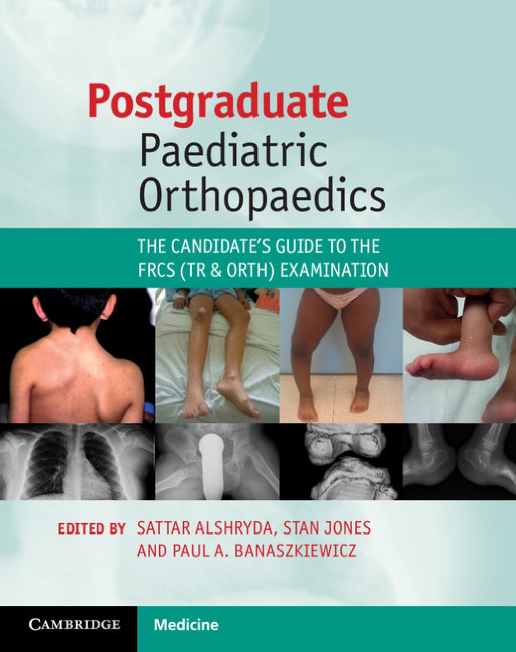 Postgraduate Paediatric Orthopaedics The Candidate's Guide to the FRCS (Tr and Orth) Examination  â€“ PDF/EPUB Version Downloadable