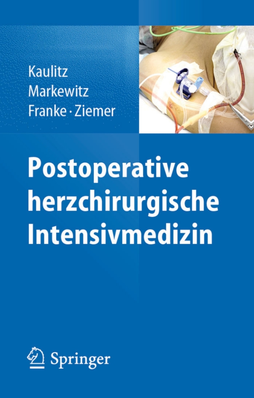 Postoperative herzchirurgische Intensivmedizin  â€“ PDF/EPUB Version Downloadable