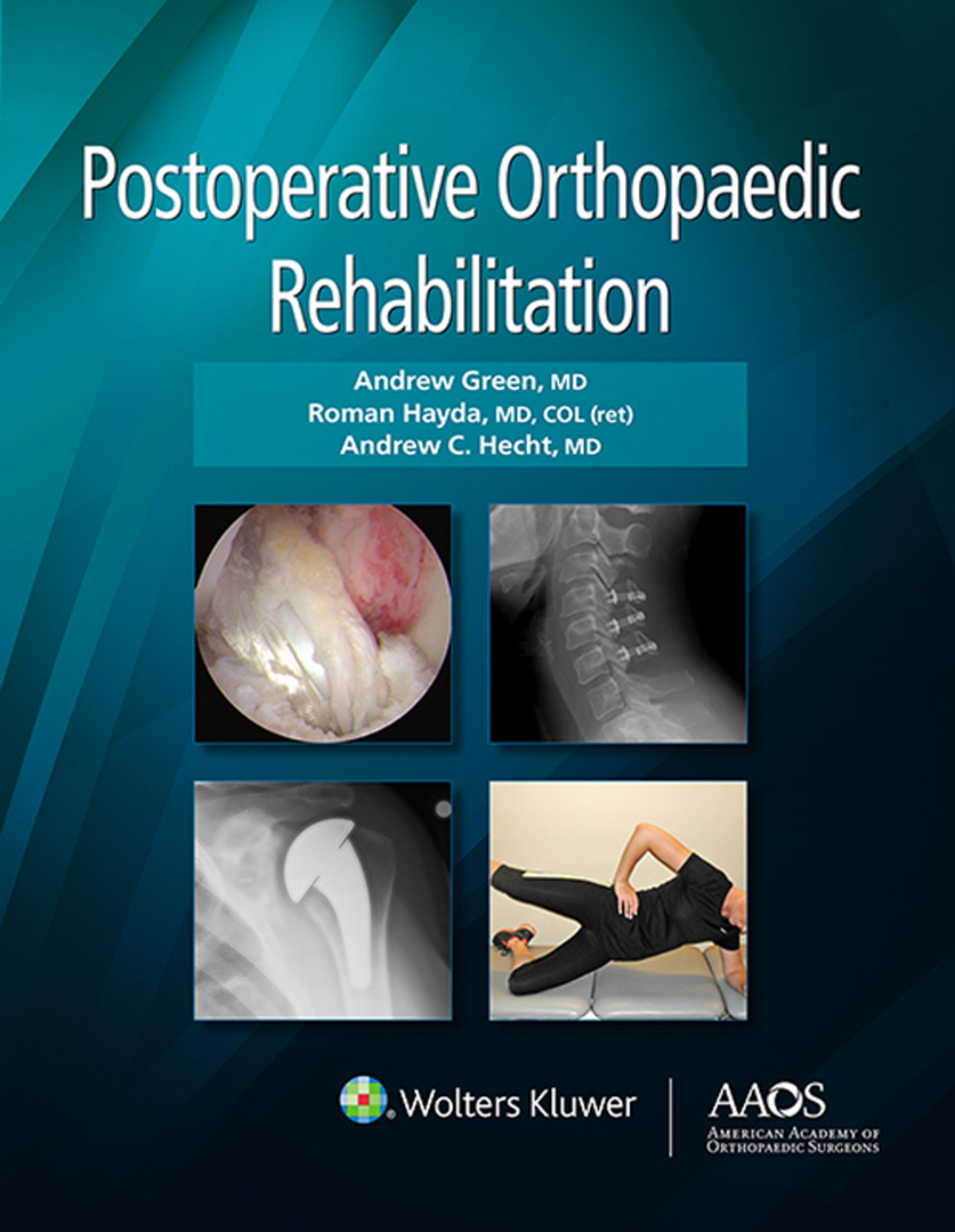 Postoperative Orthopaedic Rehabilitation  â€“ PDF/EPUB Version Downloadable