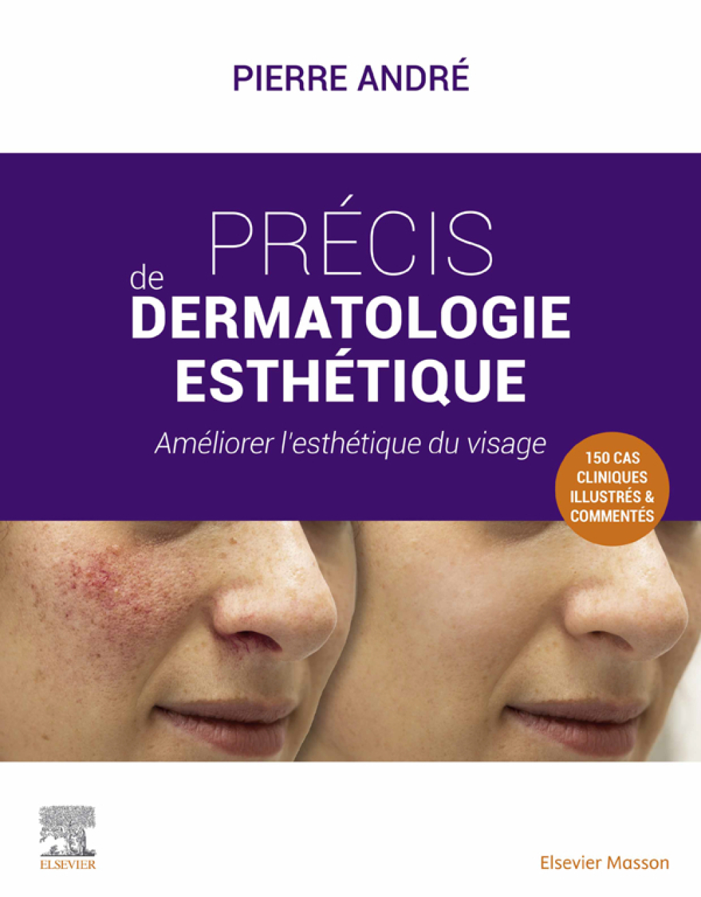 PrÃ©cis de dermatologie esthÃ©tique AmÃ©liorer lâ€™esthÃ©tique du visage  â€“ PDF/EPUB Version Downloadable