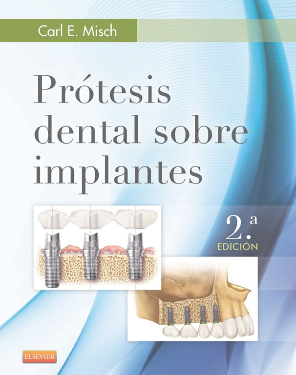 PrÃ³tesis dental sobre implantes 2nd Edition â€“ PDF/EPUB Version Downloadable