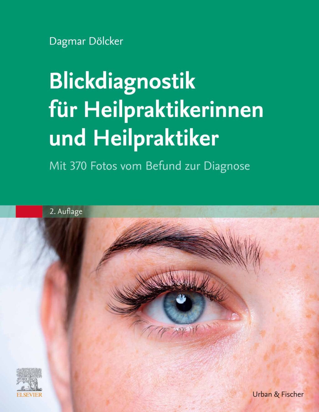 PrÃ¼fungstraining Blickdiagnostik fÃ¼r Heilpraktiker Mit 370 Fotos vom Befund zur Diagnose 2nd Edition â€“ PDF/EPUB Version Downloadable