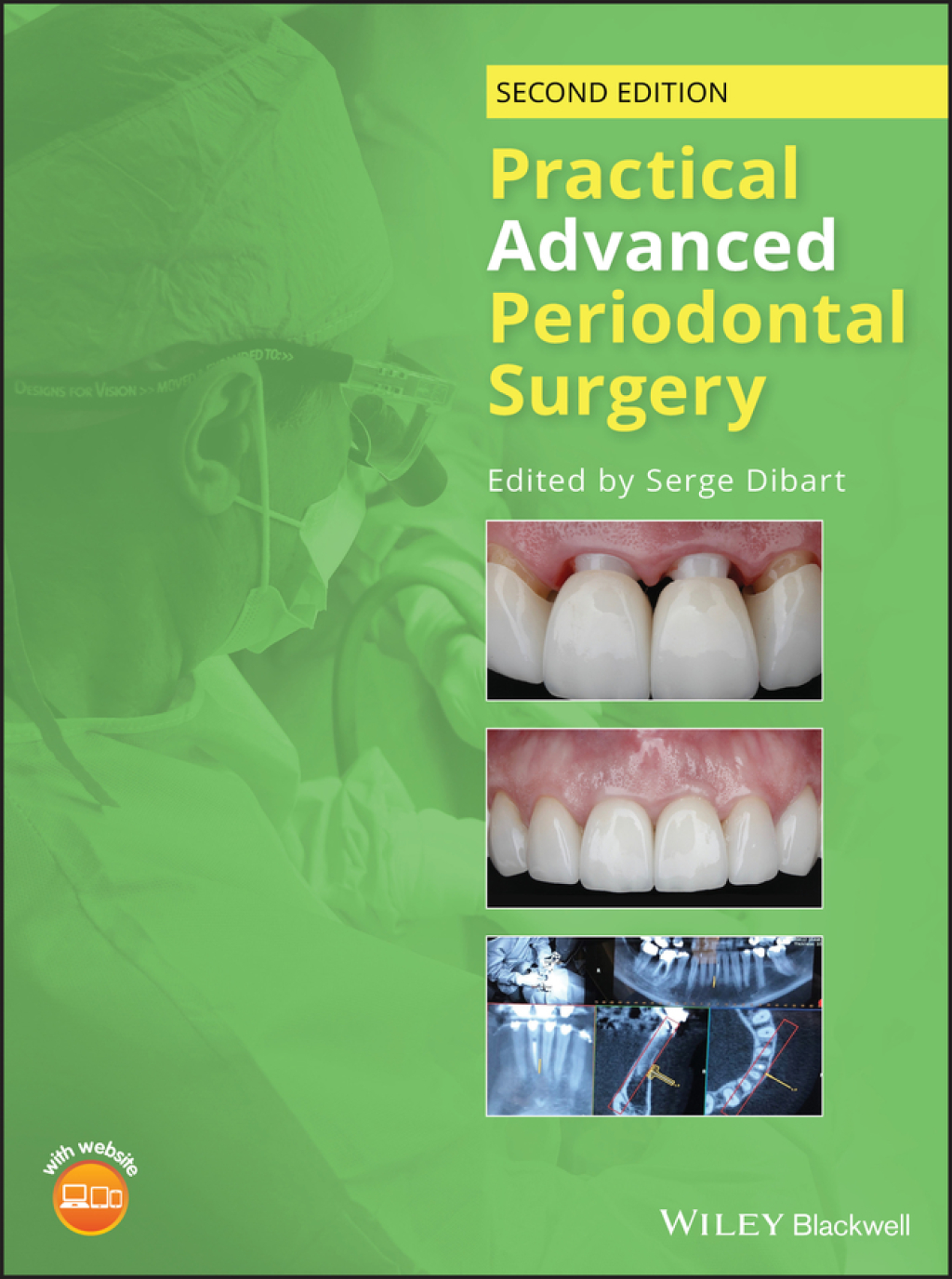Practical Advanced Periodontal Surgery 2nd Edition â€“ PDF/EPUB Version Downloadable