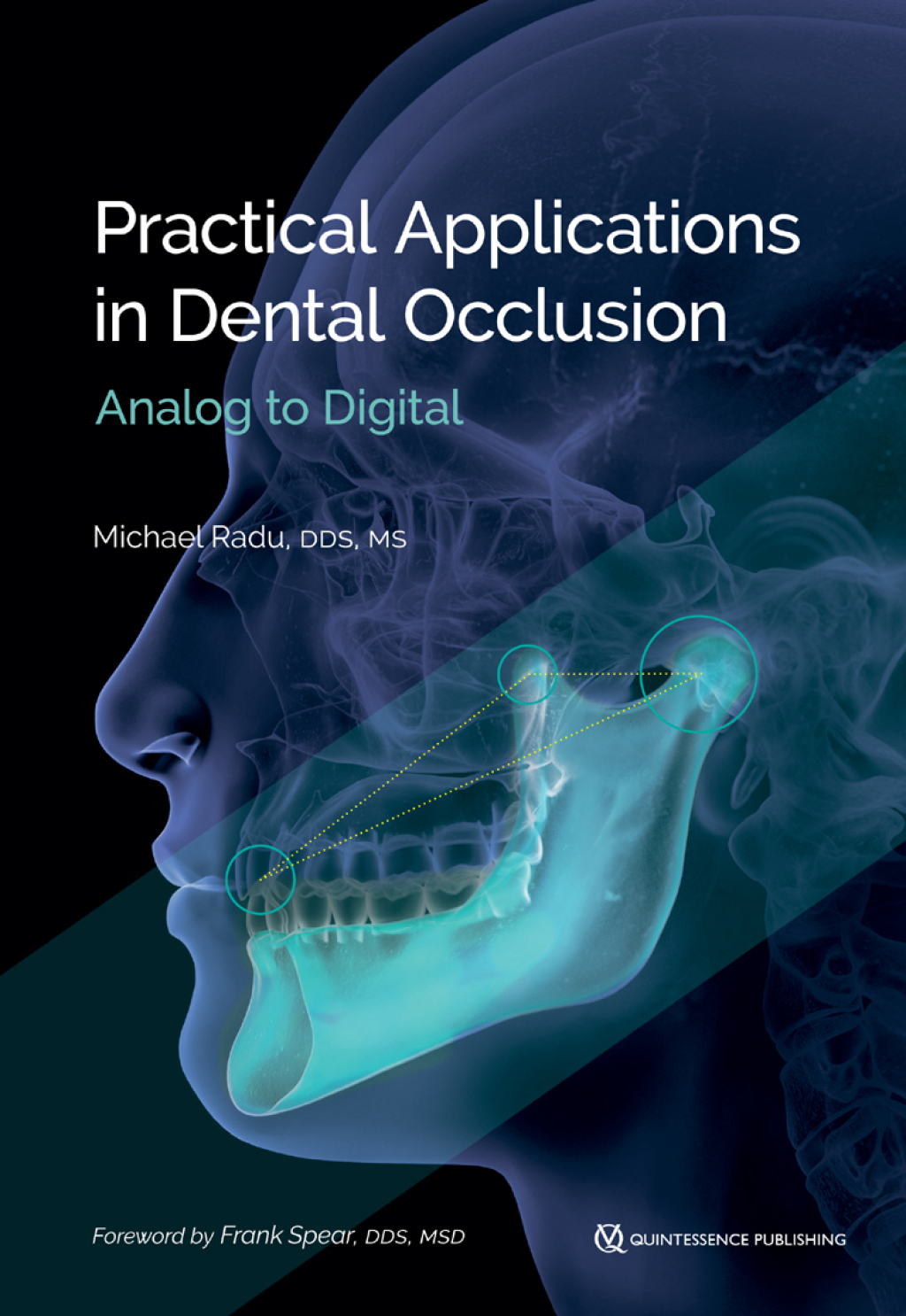 Practical Applications in Dental Occlusion: Analog to Digital 1st Edition â€“ PDF/EPUB Version Downloadable