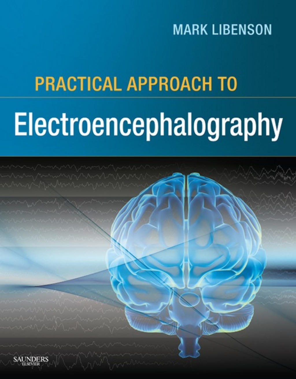 Practical Approach to Electroencephalography  â€“ PDF/EPUB Version Downloadable