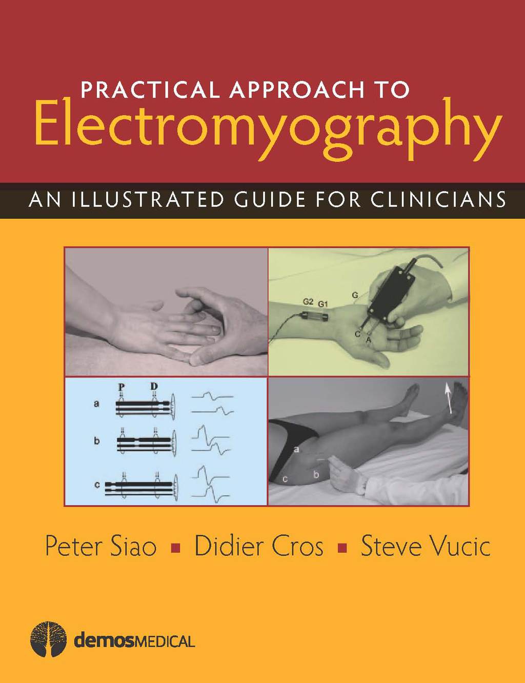 Practical Approach to Electromyography An Illustrated Guide for Clinicians 1st Edition â€“ PDF/EPUB Version Downloadable
