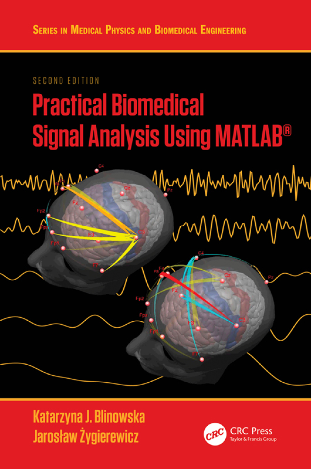 Practical Biomedical Signal Analysis Using MATLABÂ® 2nd Edition â€“ PDF/EPUB Version Downloadable
