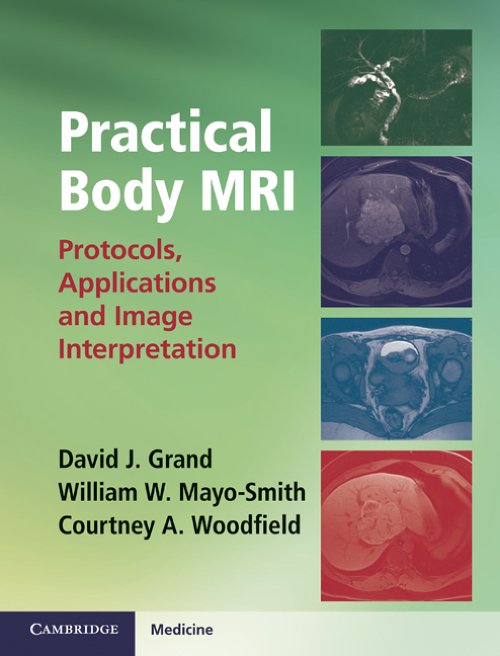 Practical Body MRI Protocols, Applications and Image Interpretation 1st Edition â€“ PDF/EPUB Version Downloadable