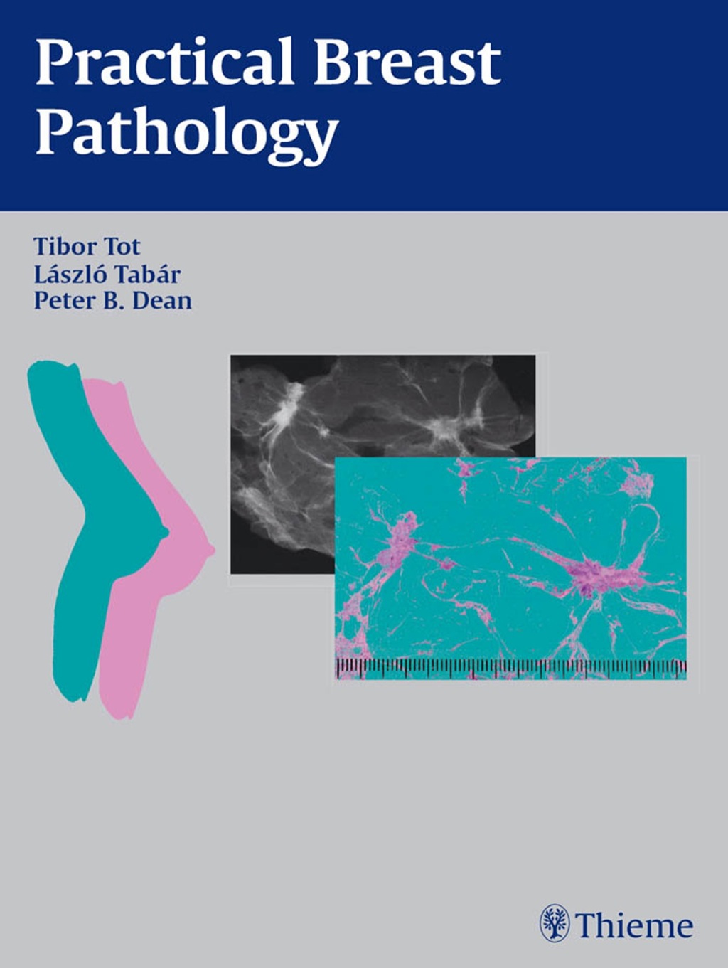 Practical Breast Pathology 1st Edition â€“ PDF/EPUB Version Downloadable