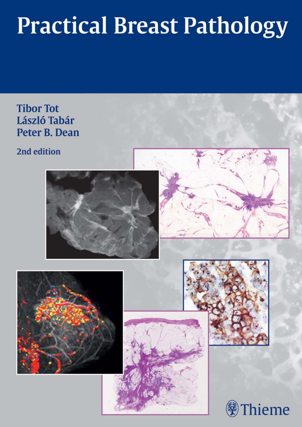 Practical Breast Pathology 2nd Edition â€“ PDF/EPUB Version Downloadable