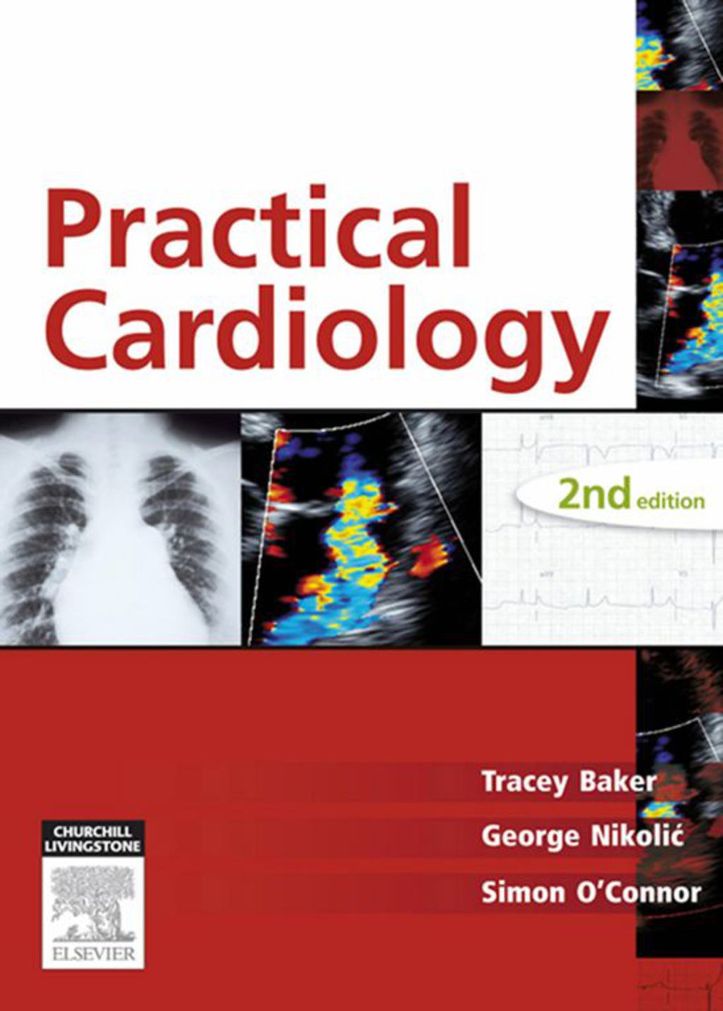 Practical Cardiology 2nd Edition â€“ PDF/EPUB Version Downloadable