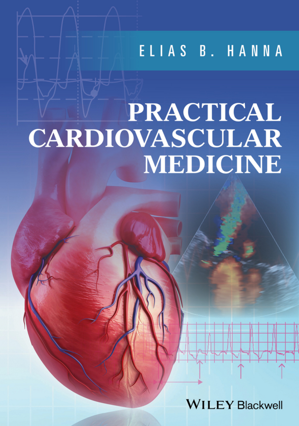 Practical Cardiovascular Medicine 1st Edition â€“ PDF/EPUB Version Downloadable