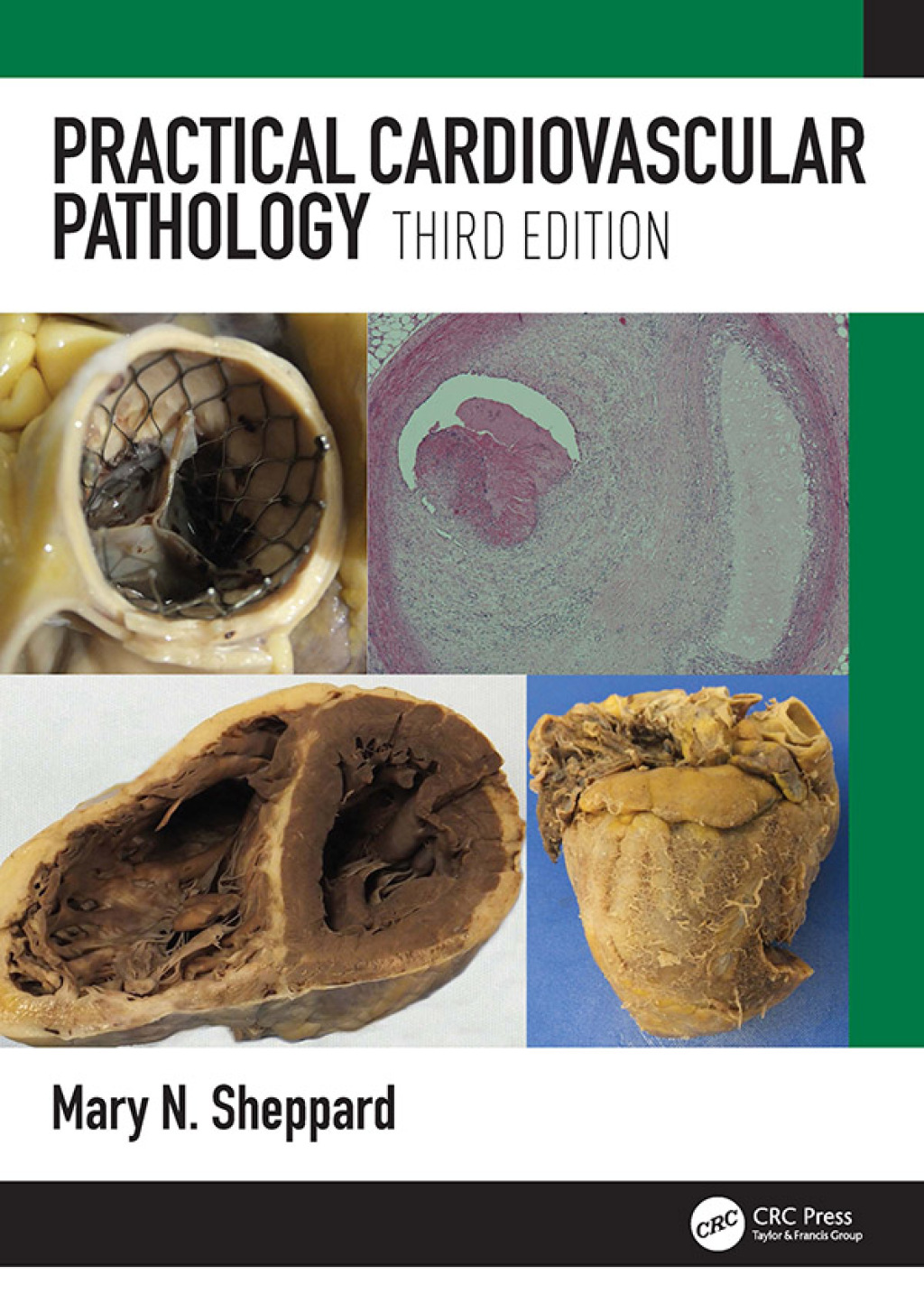 Practical Cardiovascular Pathology 3rd Edition â€“ PDF/EPUB Version Downloadable