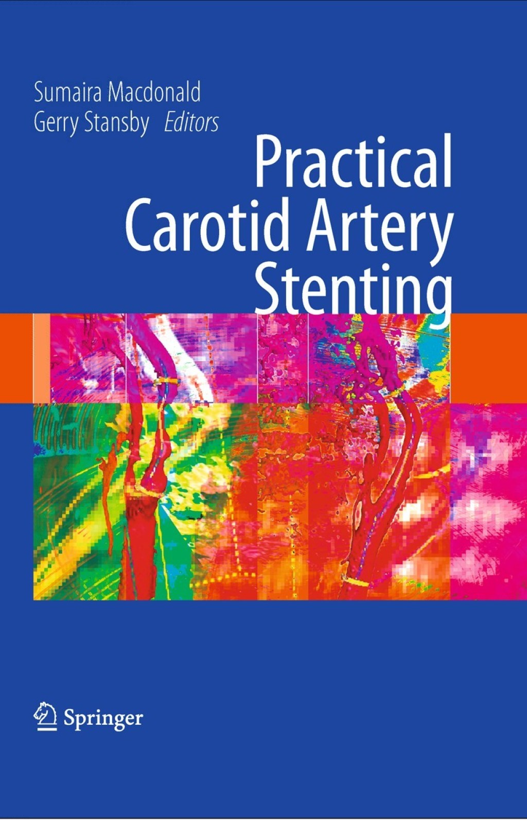 Practical Carotid Artery Stenting 1st Edition â€“ PDF/EPUB Version Downloadable