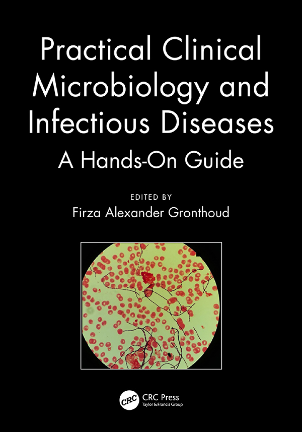 Practical Clinical Microbiology and Infectious Diseases A Hands-On Guide 1st Edition â€“ PDF/EPUB Version Downloadable