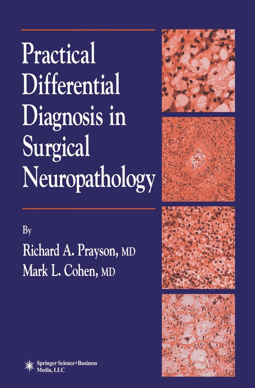 Practical Differential Diagnosis in Surgical Neuropathology  â€“ PDF/EPUB Version Downloadable