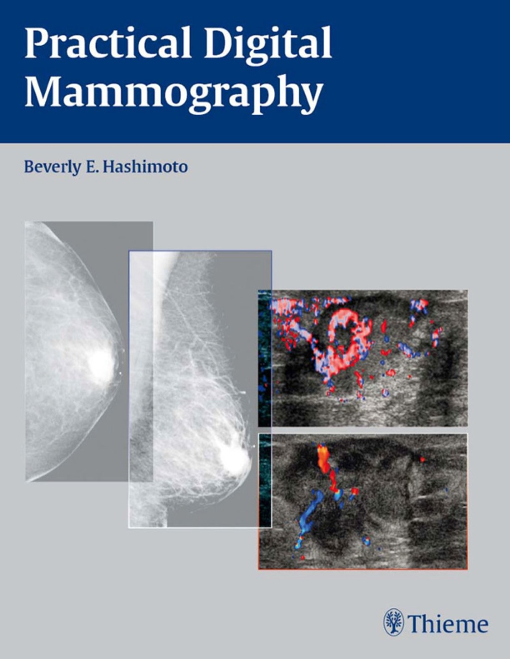 Practical Digital Mammography 1st Edition â€“ PDF/EPUB Version Downloadable