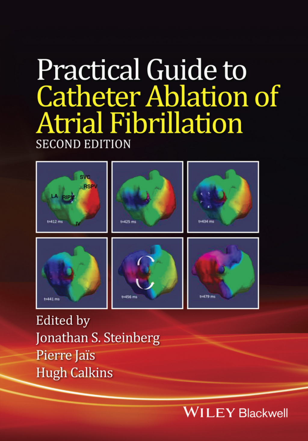 Practical Guide to Catheter Ablation of Atrial Fibrillation, 2nd Edition 2nd Edition â€“ PDF/EPUB Version Downloadable