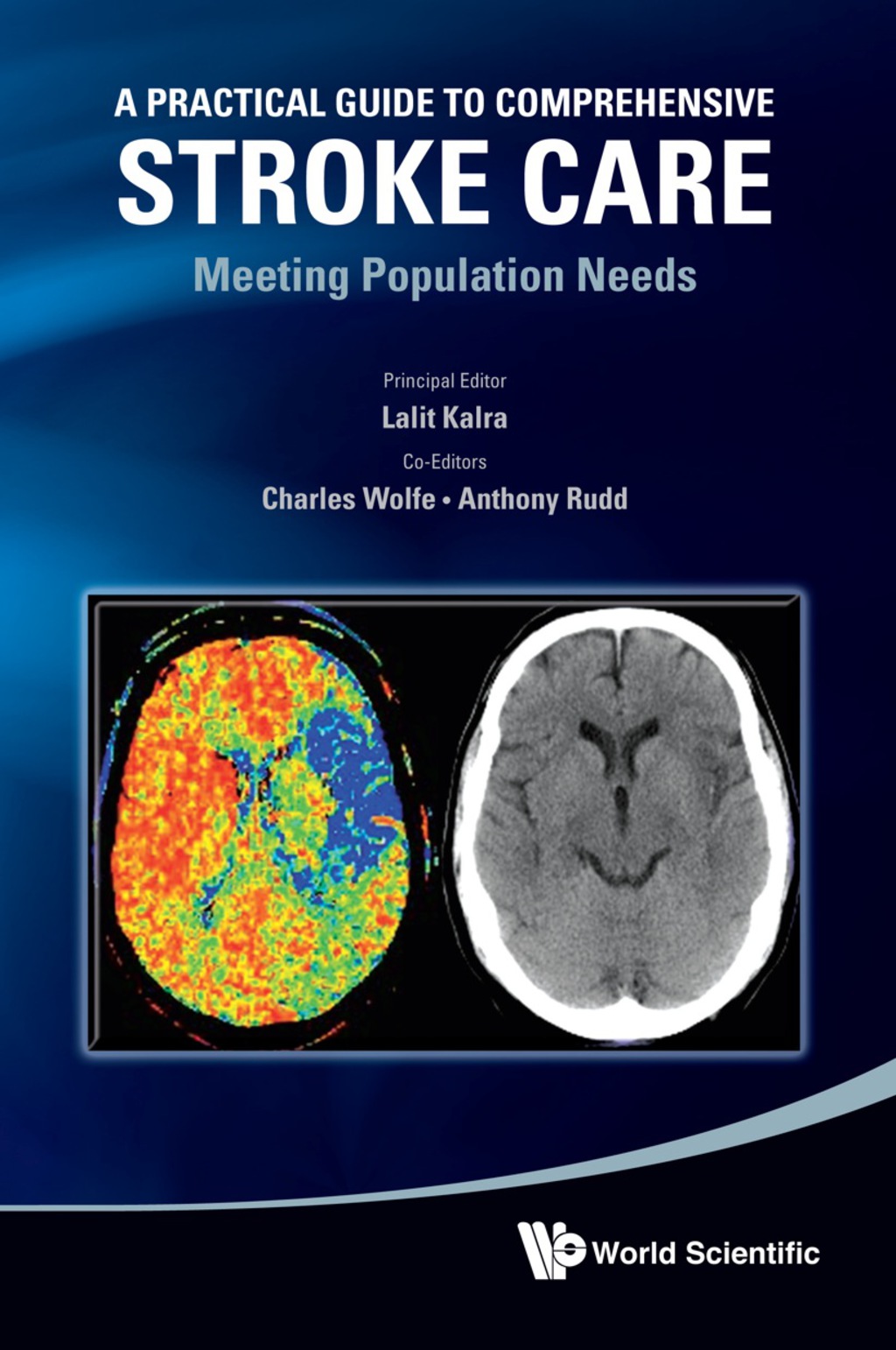 Practical Guide To Comprehensive Stroke Care, A: Meeting Population Needs  â€“ PDF/EPUB Version Downloadable