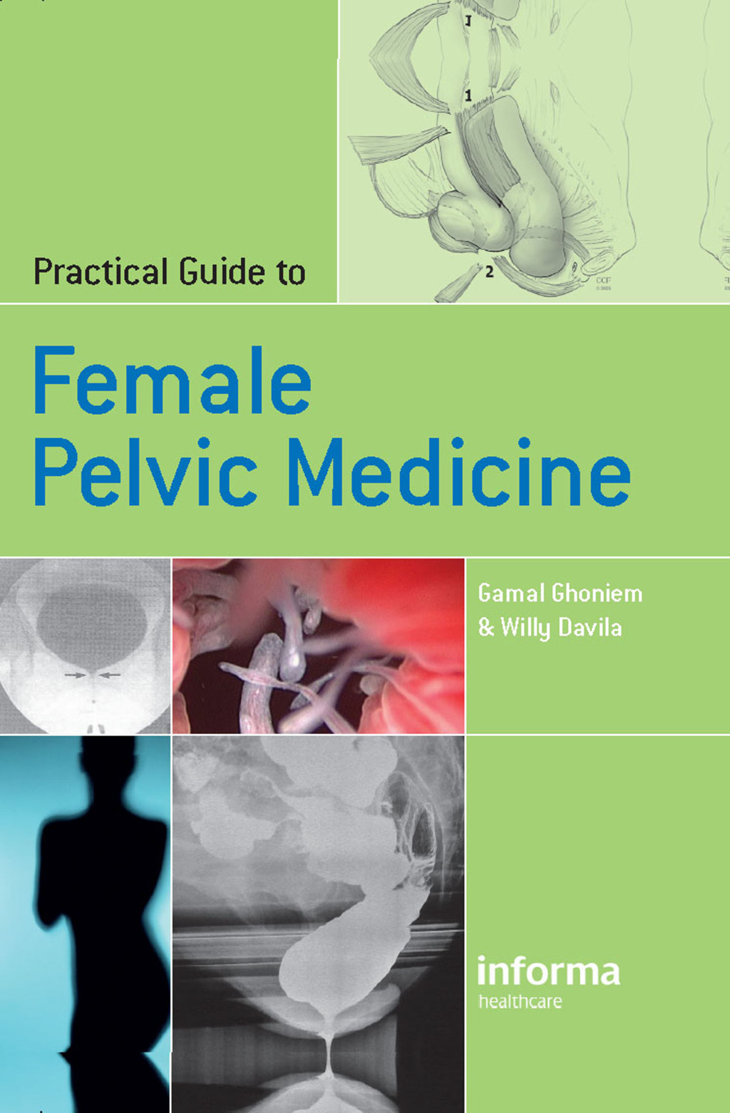 Practical Guide to Female Pelvic Medicine 1st Edition â€“ PDF/EPUB Version Downloadable