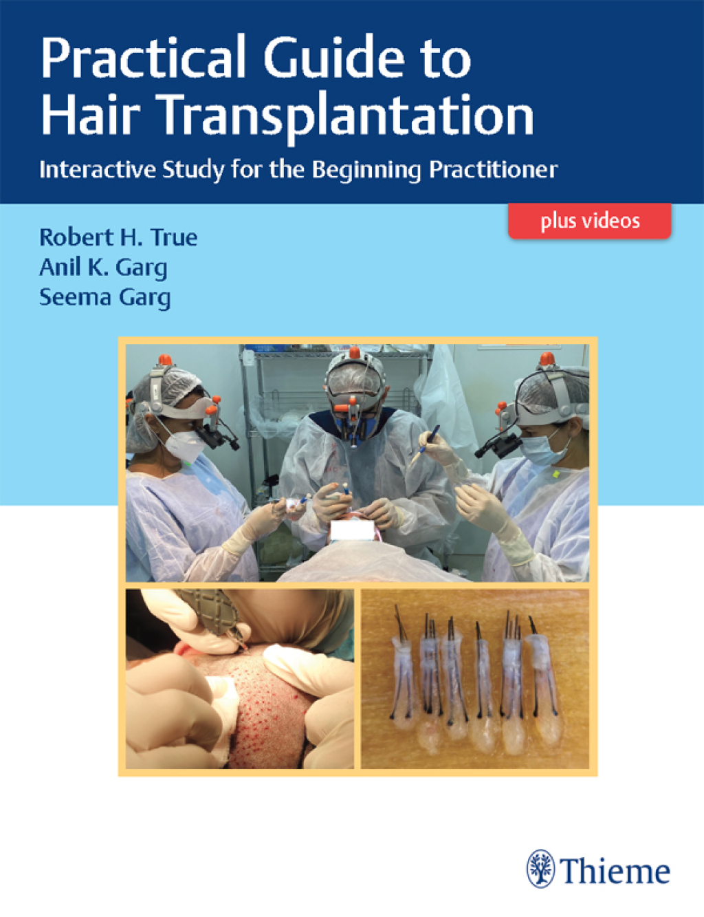 Practical Guide to Hair Transplantation Interactive Study for the Beginning Practitioner 1st Edition â€“ PDF/EPUB Version Downloadable