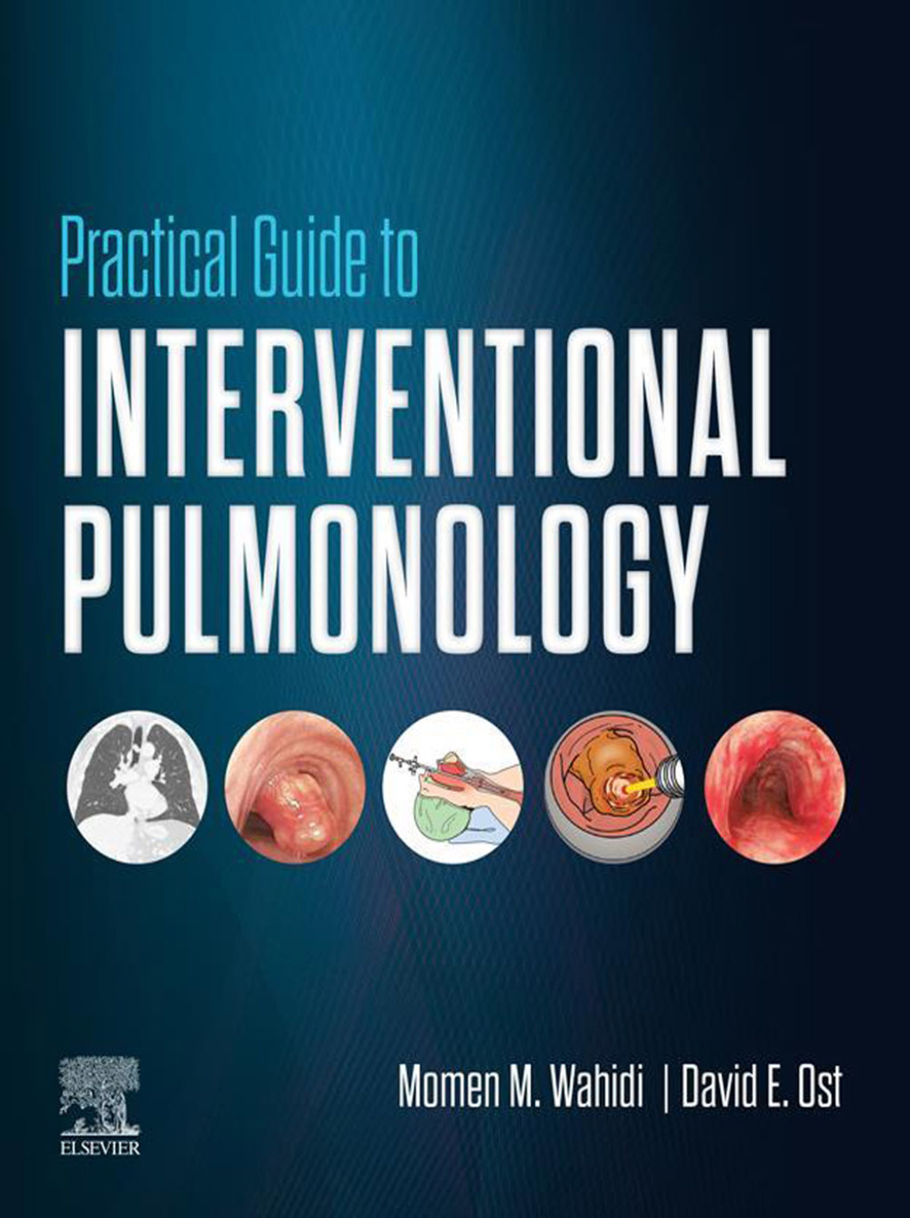 Practical Guide to Interventional Pulmonology - Electronic 1st Edition â€“ PDF/EPUB Version Downloadable