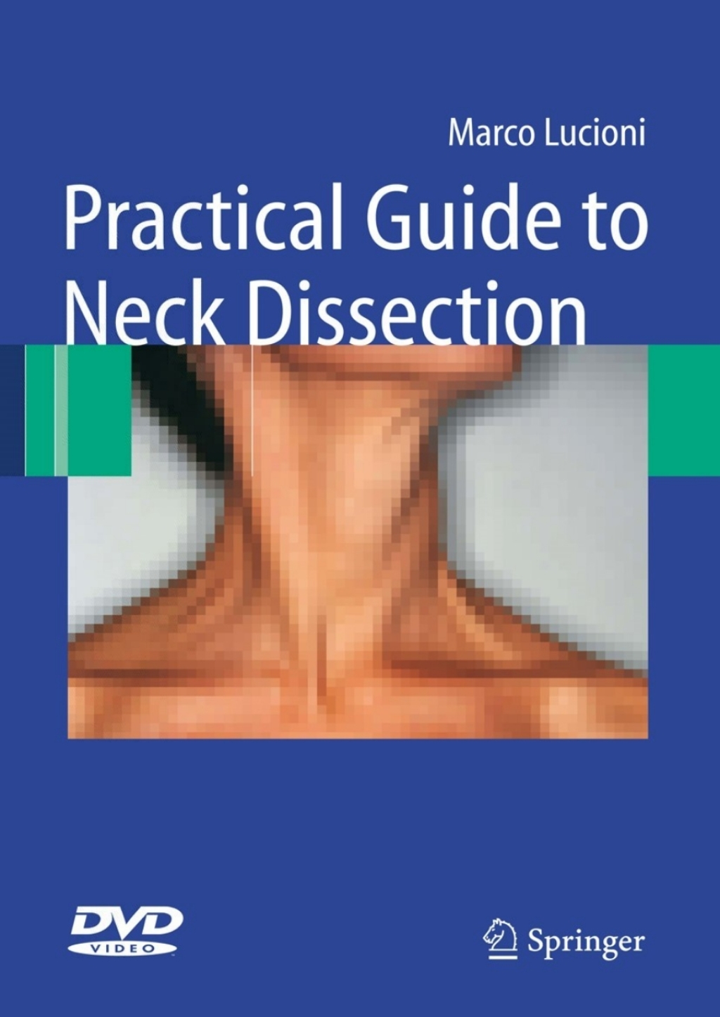 Practical Guide to Neck Dissection  â€“ PDF/EPUB Version Downloadable