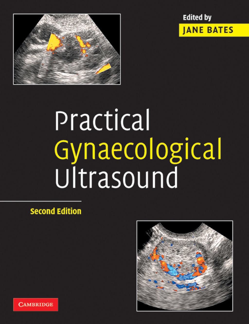 Practical Gynaecological Ultrasound 2nd Edition â€“ PDF/EPUB Version Downloadable