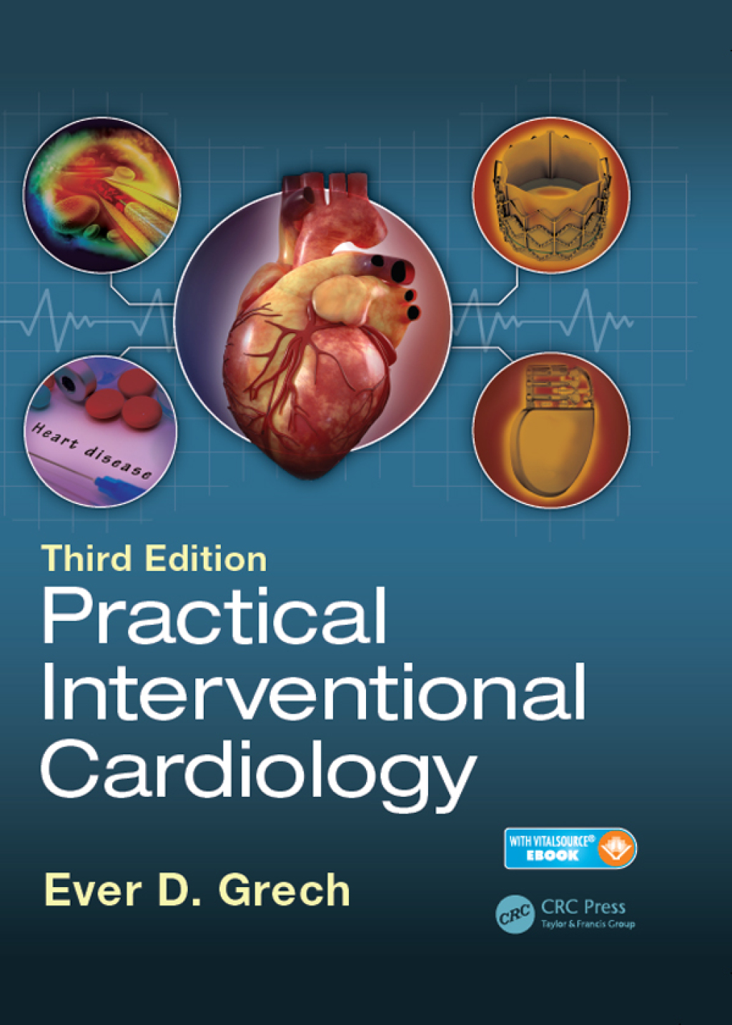 Practical Interventional Cardiology Third Edition 3rd Edition â€“ PDF/EPUB Version Downloadable
