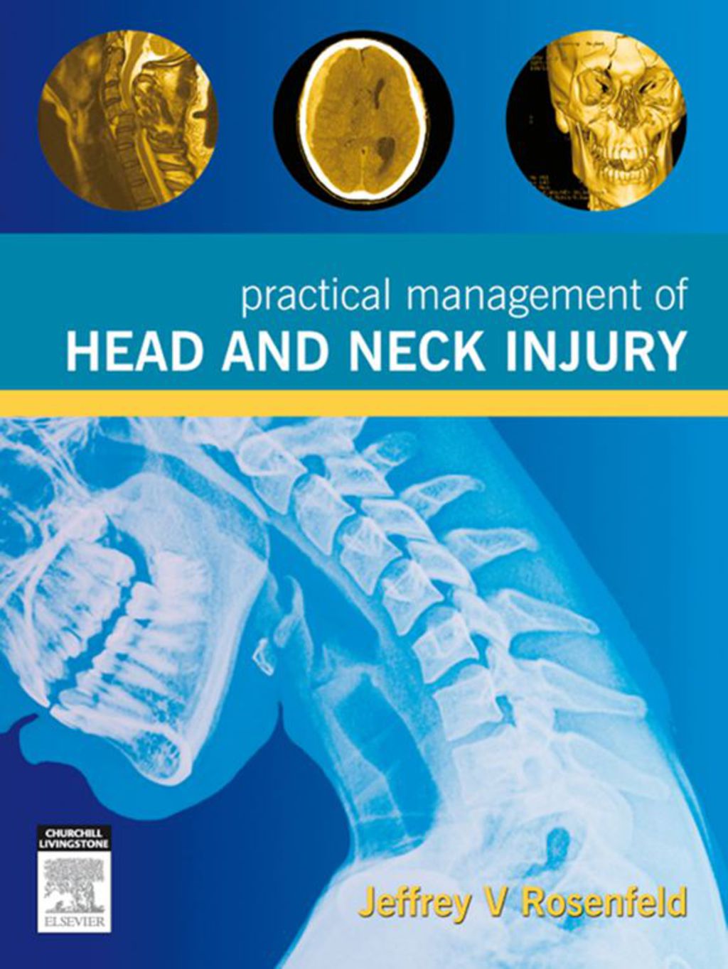 Practical Management of Head and Neck Injury 1st Edition â€“ PDF/EPUB Version Downloadable