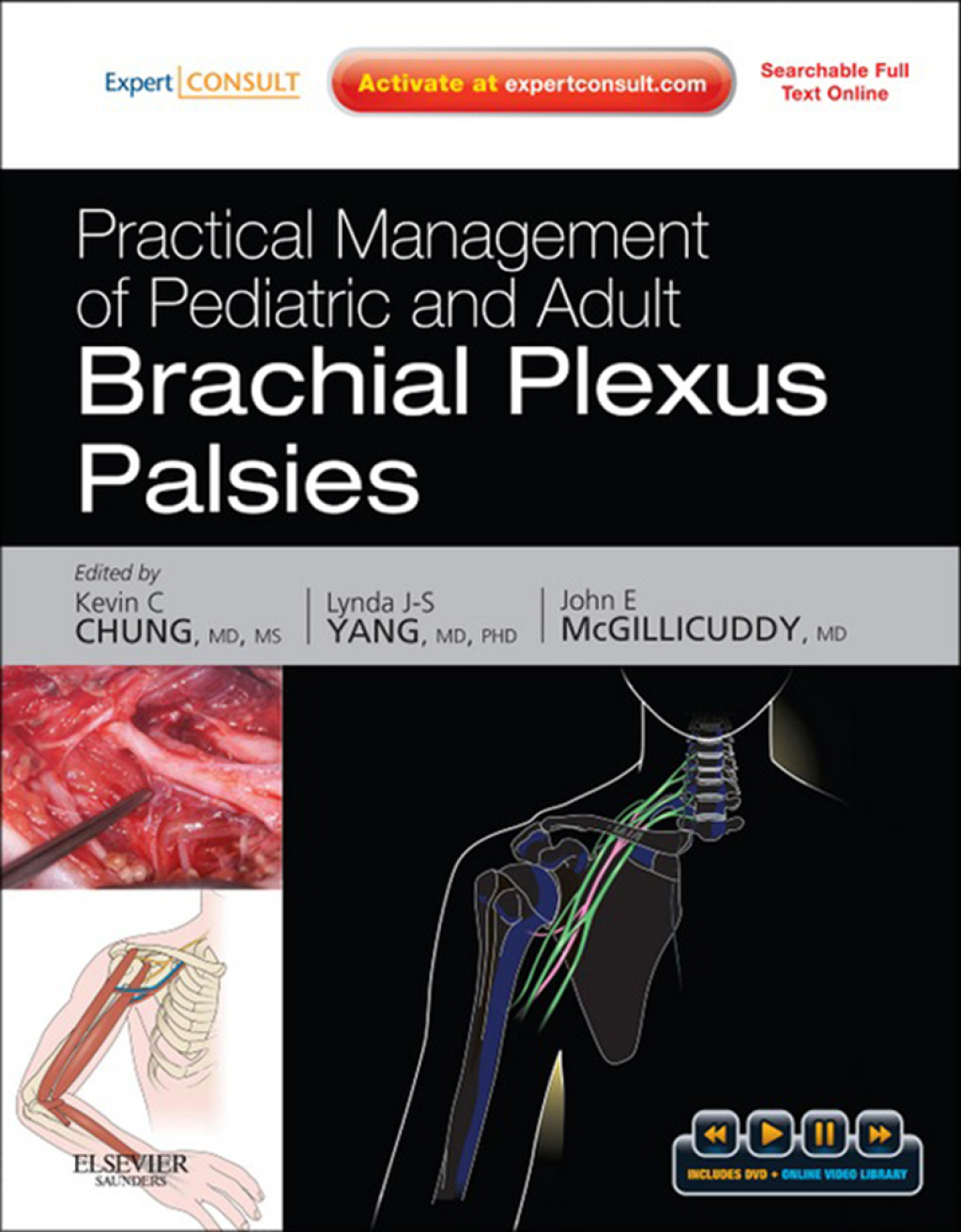 Practical Management of Pediatric and Adult Brachial Plexus Palsies - Electronic 1st Edition â€“ PDF/EPUB Version Downloadable