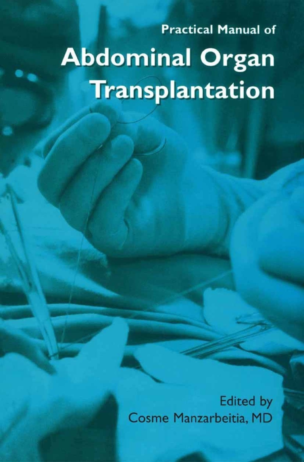 Practical Manual of Abdominal Organ Transplantation 1st Edition â€“ PDF/EPUB Version Downloadable