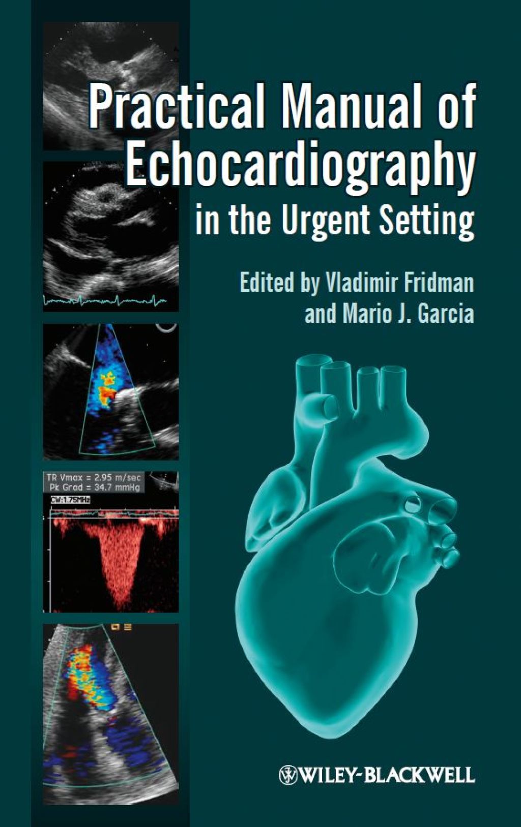 Practical Manual of Echocardiography in the Urgent Setting 1st Edition â€“ PDF/EPUB Version Downloadable
