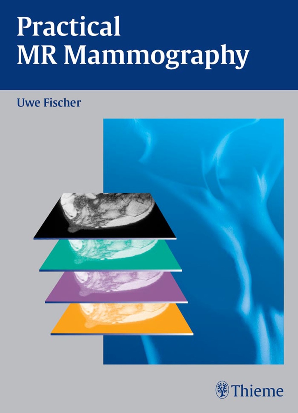Practical MR Mammography 1st Edition â€“ PDF/EPUB Version Downloadable