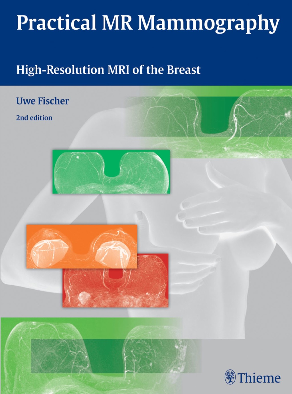 Practical MR Mammography High-Resolution MRI of the Breast 2nd Edition â€“ PDF/EPUB Version Downloadable