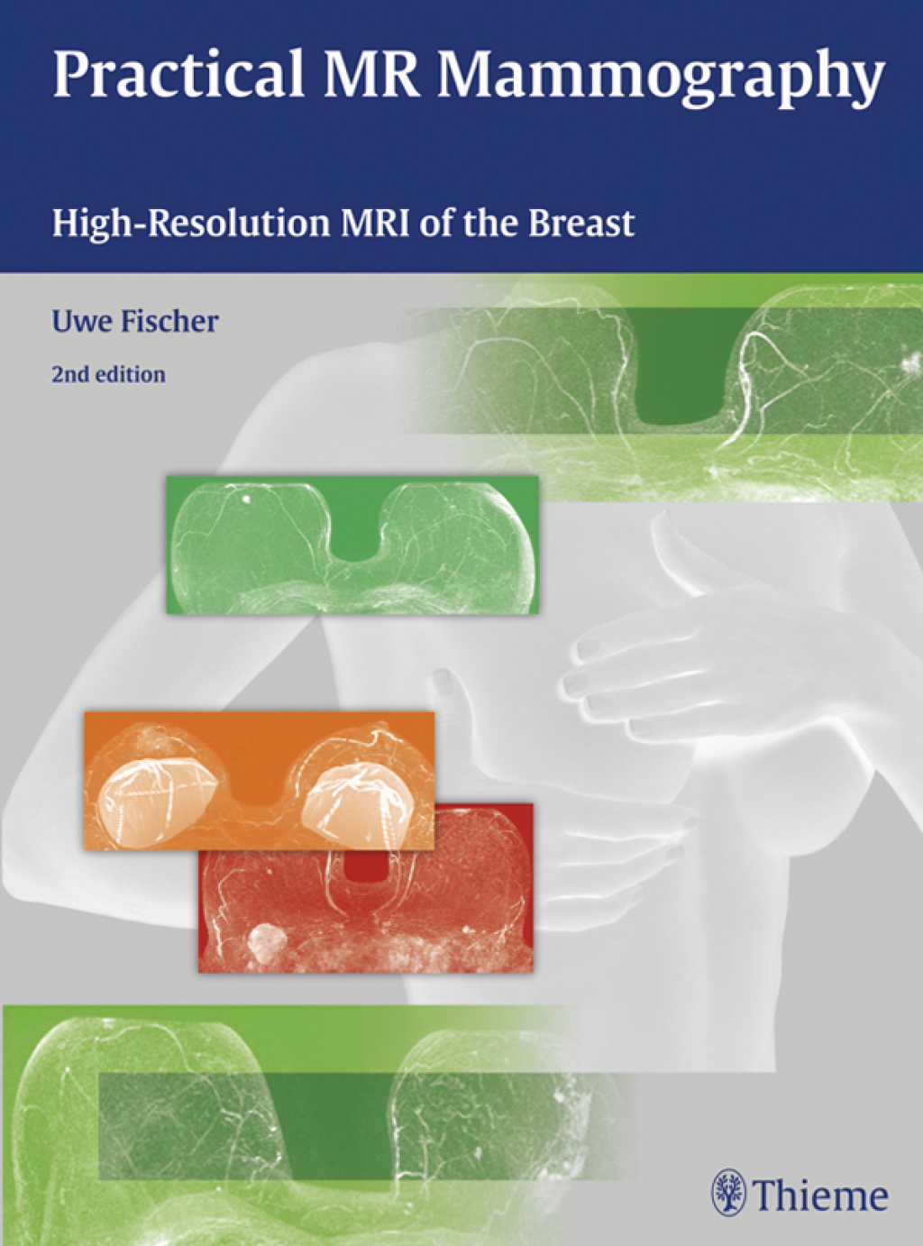 Practical MR Mammography High-Resolution MRI of the Breast 2nd Edition â€“ PDF/EPUB Version Downloadable