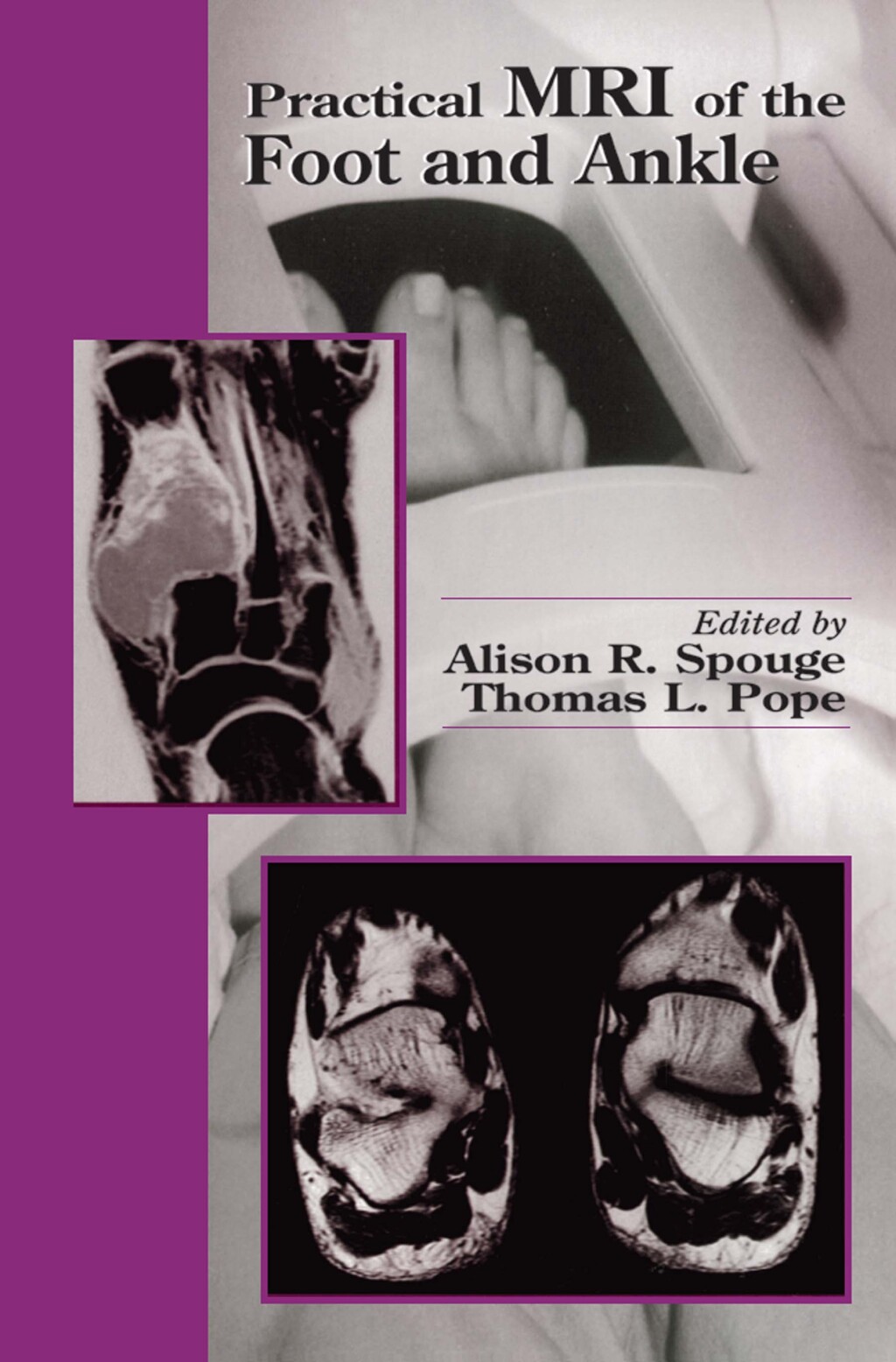 Practical MRI of the Foot and Ankle 1st Edition â€“ PDF/EPUB Version Downloadable