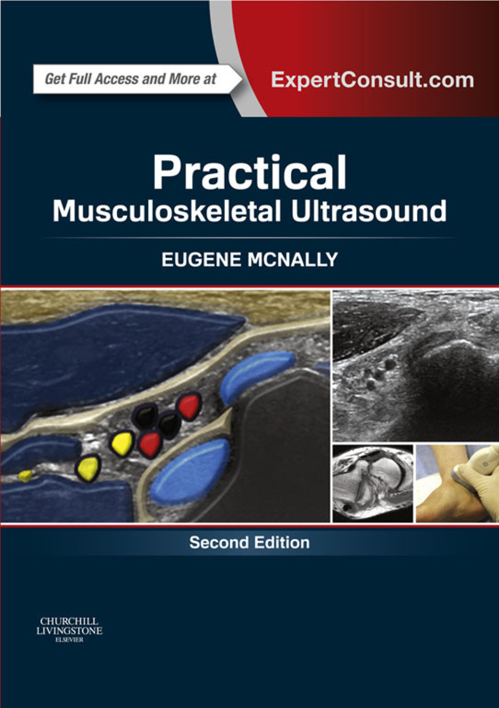 Practical Musculoskeletal Ultrasound - Electronic 2nd Edition â€“ PDF/EPUB Version Downloadable