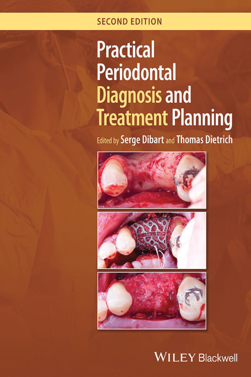 Practical Periodontal Diagnosis and Treatment Planning 2nd Edition â€“ PDF/EPUB Version Downloadable