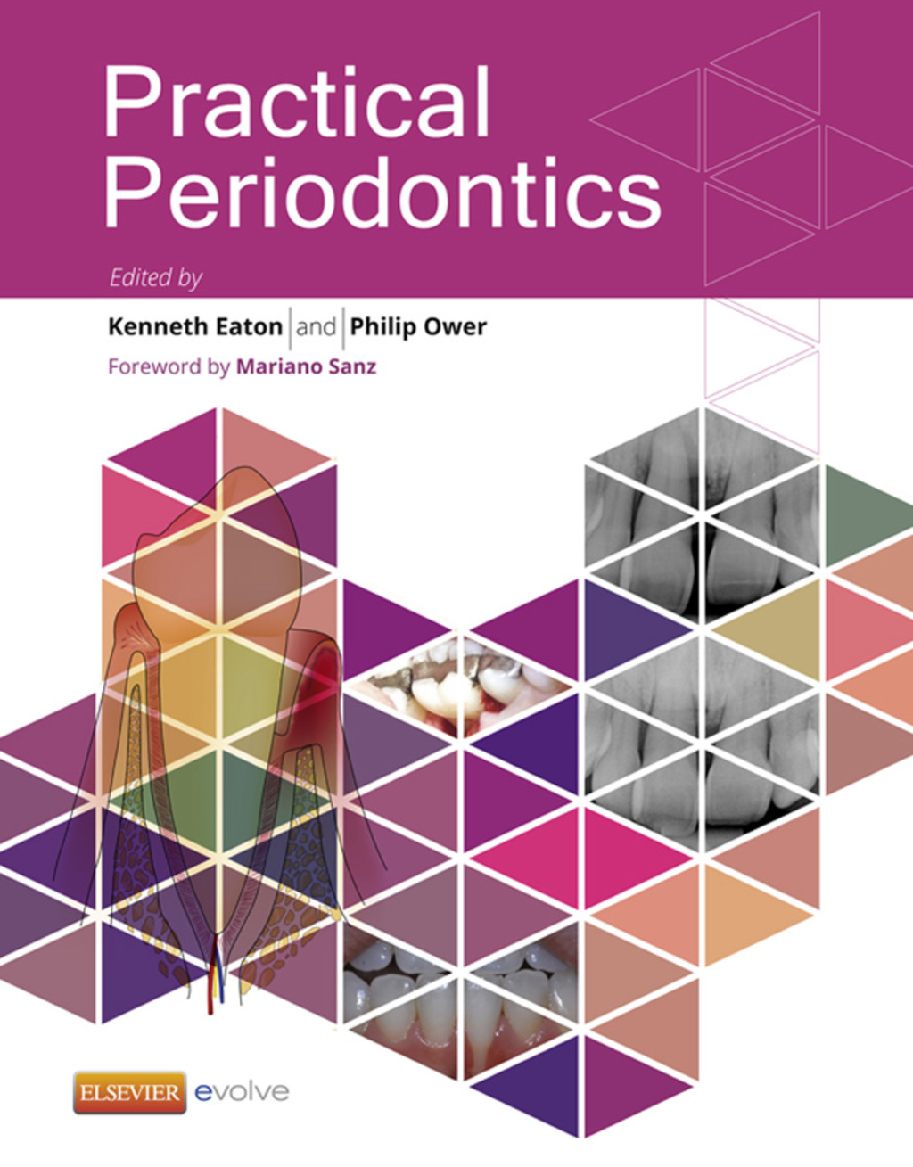 Practical Periodontics  â€“ PDF/EPUB Version Downloadable